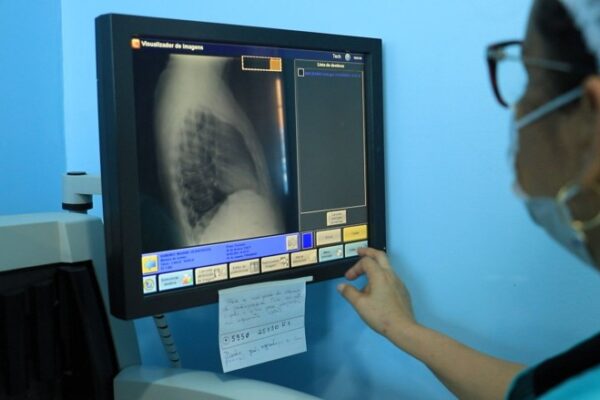 Mês de conscientização à tuberculose reforça a necessidade de combater a doença