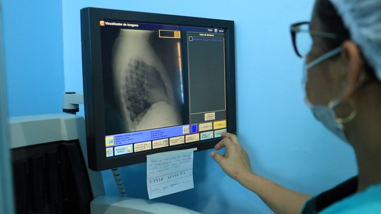 Mês de conscientização à tuberculose reforça a necessidade de combater a doença