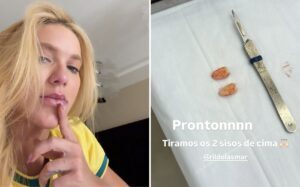 Virginia Fonseca retira dois sisos após sentir fortes dores