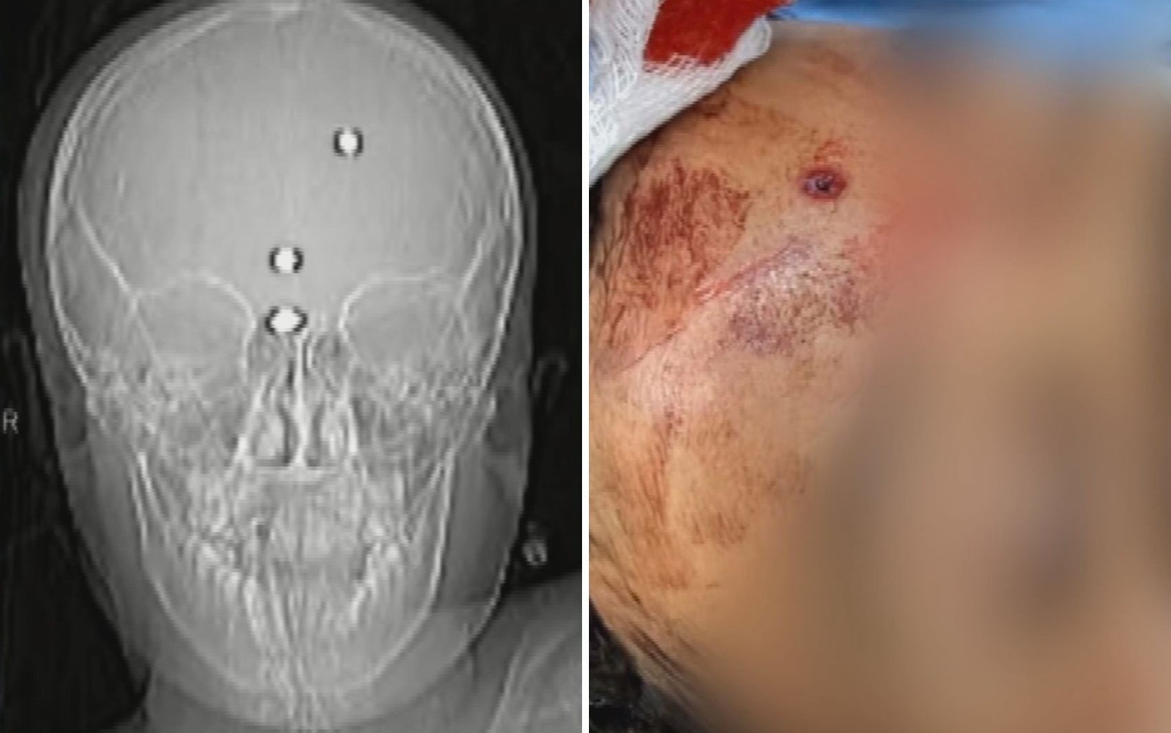 www.deixaeutefalar.com.br Menino baleado na cabeça acorda, volta a falar e pede para ir para casa